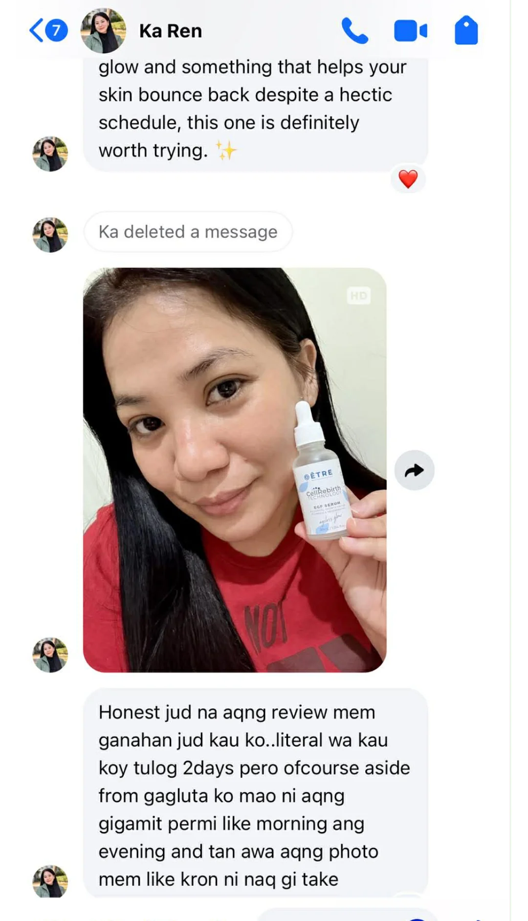 EGF Serum Testimonials - Glow and something that helps your skin bounce back despite a hectic schedule, this one is definitely worth trying. Honest jud na akong review, ganahan jud kaayo ko. Literal wa kaayo koy tulog 2 days pero ofcourse aside from gagluta ko mao ni akong gigamit permi like morning and evening, and tan-awa akong photo, karon ni mako gitake.